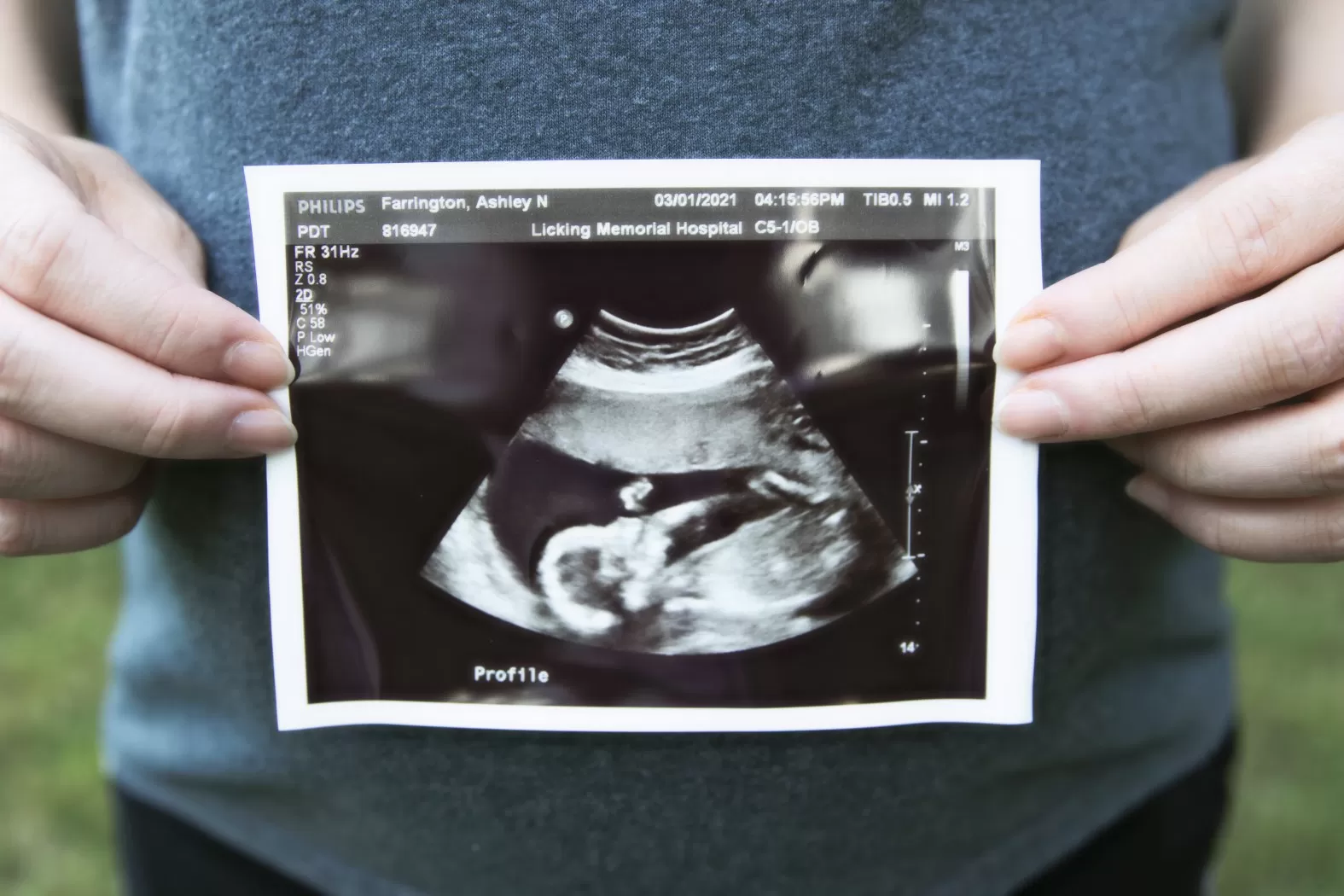 Maternity 9